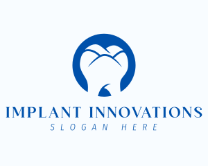 Implant - Molar Tooth Hills logo design