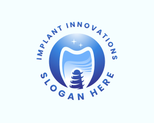 Implant - Tooth Implant Clinic logo design
