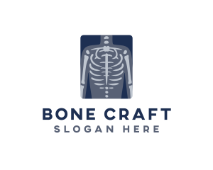 Bones - Medical X-ray Scan logo design