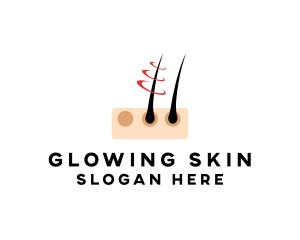 Hair Follicle Removal logo design