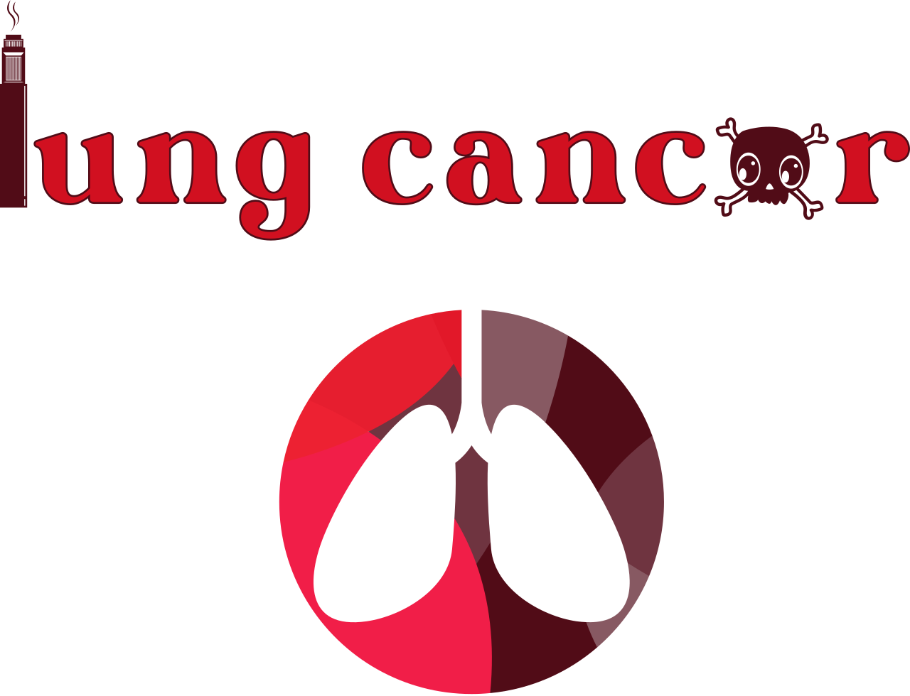 lung cancer squ's web page