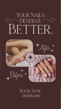 Nail Before and After Instagram Reel Preview