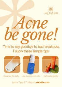 Acne Treatment Tips Poster Preview