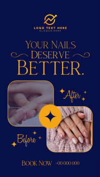 Nail Before and After Video Preview