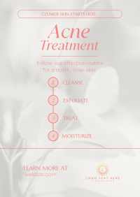 Acne Treatment Routine Poster Preview