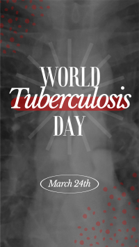 World Tuberculosis Day Instagram story Image Preview